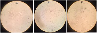 Exosomes secreted by Blastocystis subtypes affect the expression of proinflammatory and anti-inflammatory cytokines (TNFα, IL-6, IL-10, IL-4)